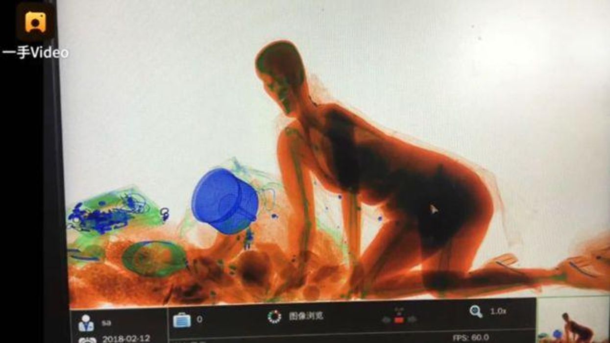 Chinese X-Ray