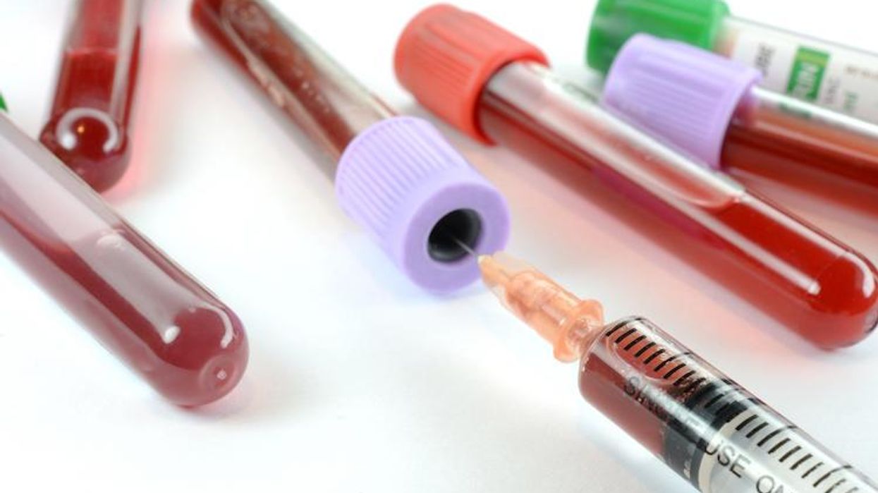 Tanzania Outlaws HIV/AIDS Outreach Programs