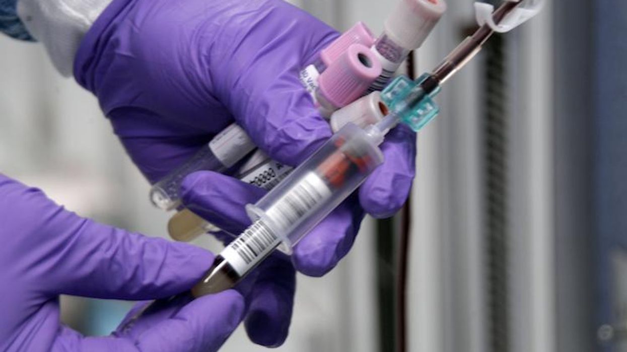 HIV Infections Soar Among Gay, Bisexual Men in the South