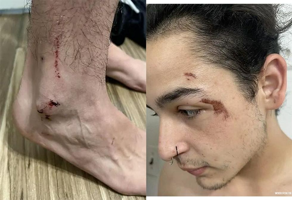 Trans Man Brutally Assaulted For Using Women\u2019s Restroom at Campground