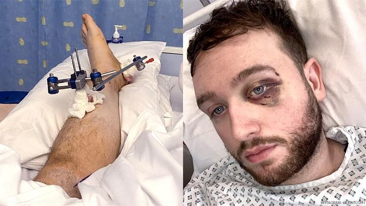 Evan Somers gay rugby player attacked